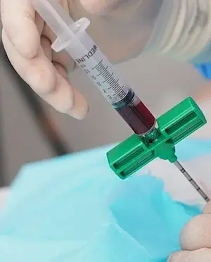 Xcell BMC rengerative medical product details