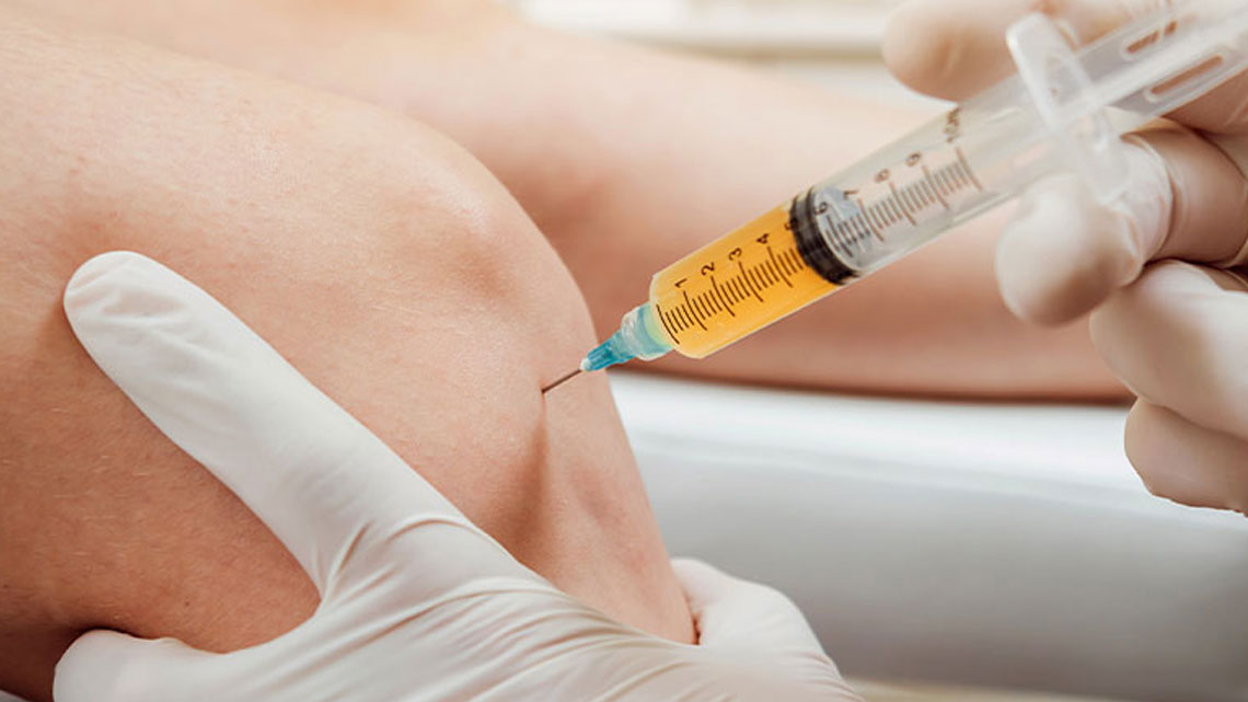 Top 3 Questions Patients Ask About PRP Injections